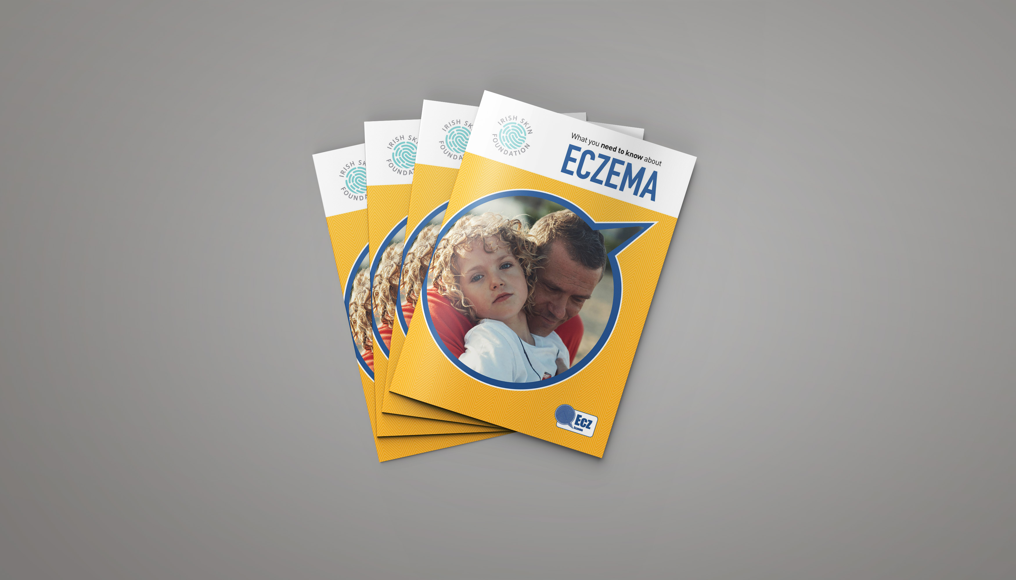 Eczema Information On Daily Management And Care